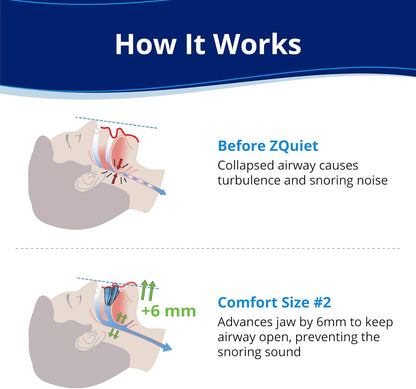TrueAmorre Comfort Snoring Solution